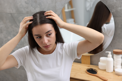 Dandruff Causes: How Hard Water Affects Your Scalp